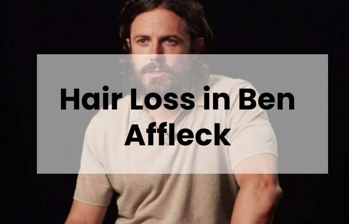 Hair Loss in Ben Affleck